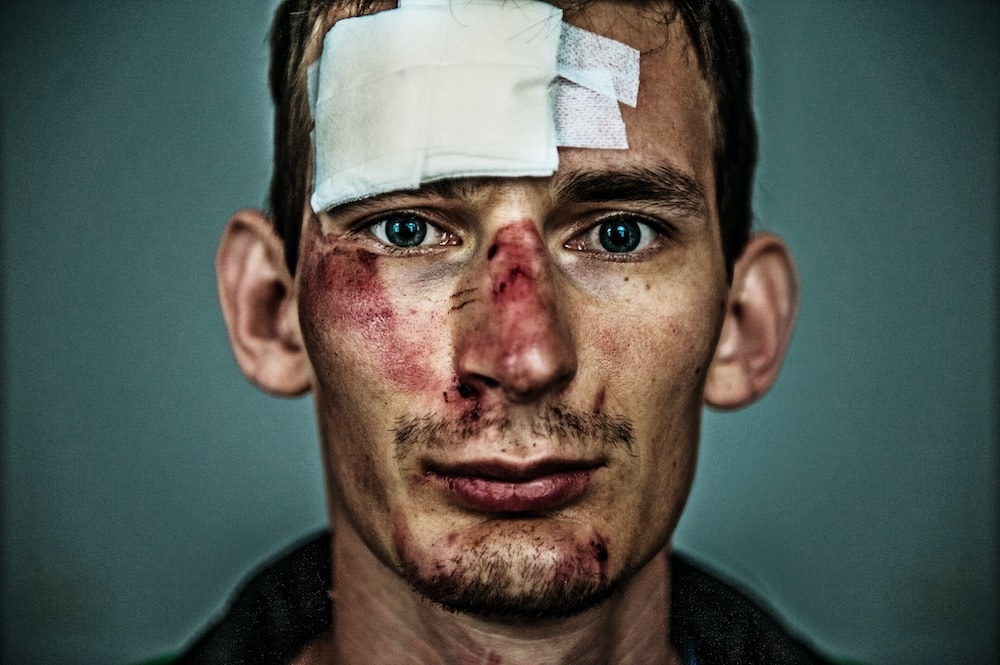 5 Types of Brain Injuries Caused By Truck Accidents