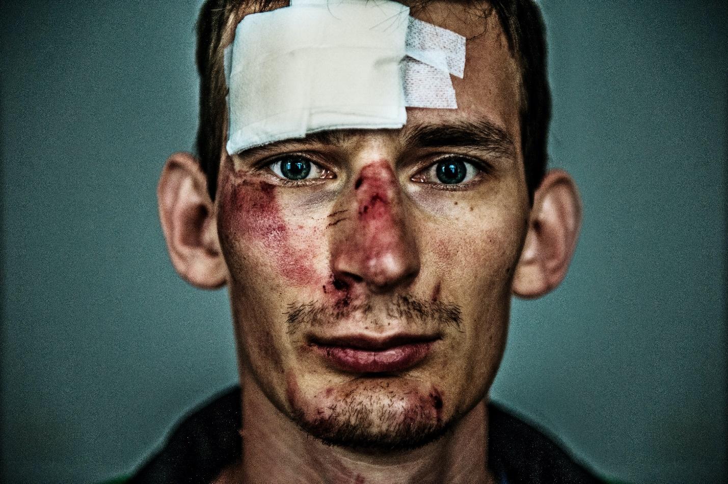 Head Injury vs. Brain Injury – Key Differences to Know