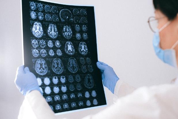 Hire a brain injury attorney in Nevada!